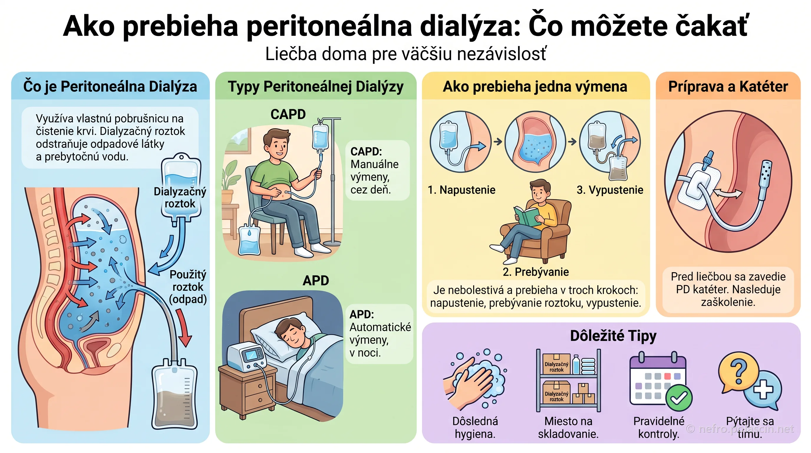 Infografika: peritoneálna dialýza — princíp, výmena roztoku, CAPD a APD a príprava na liečbu